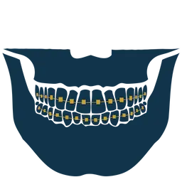 Orthognathic surgery.