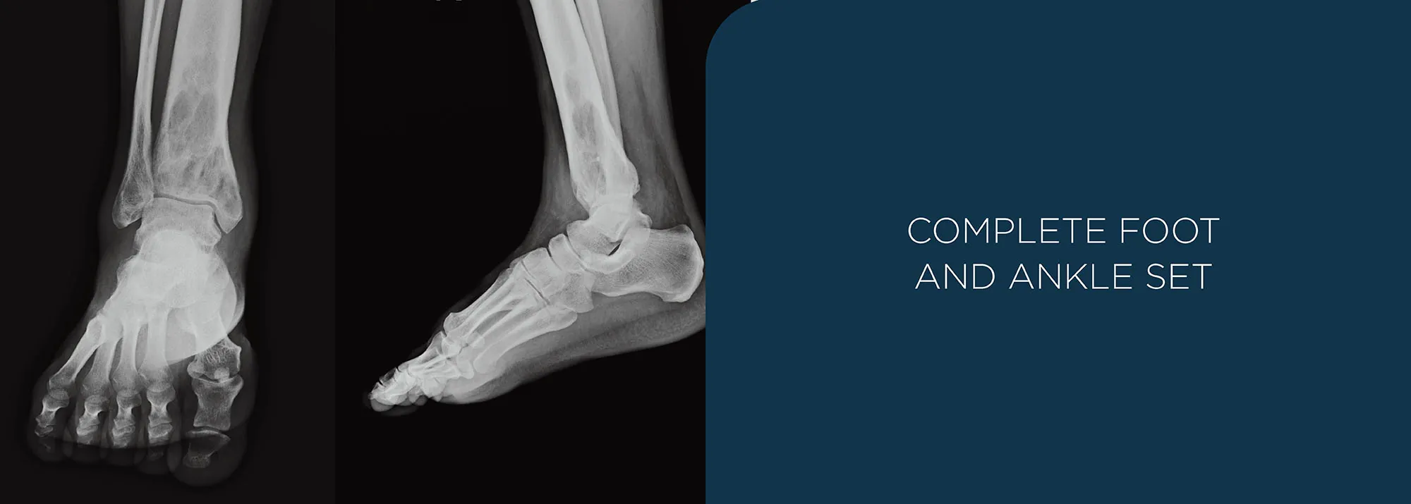 complete foot and ankle set