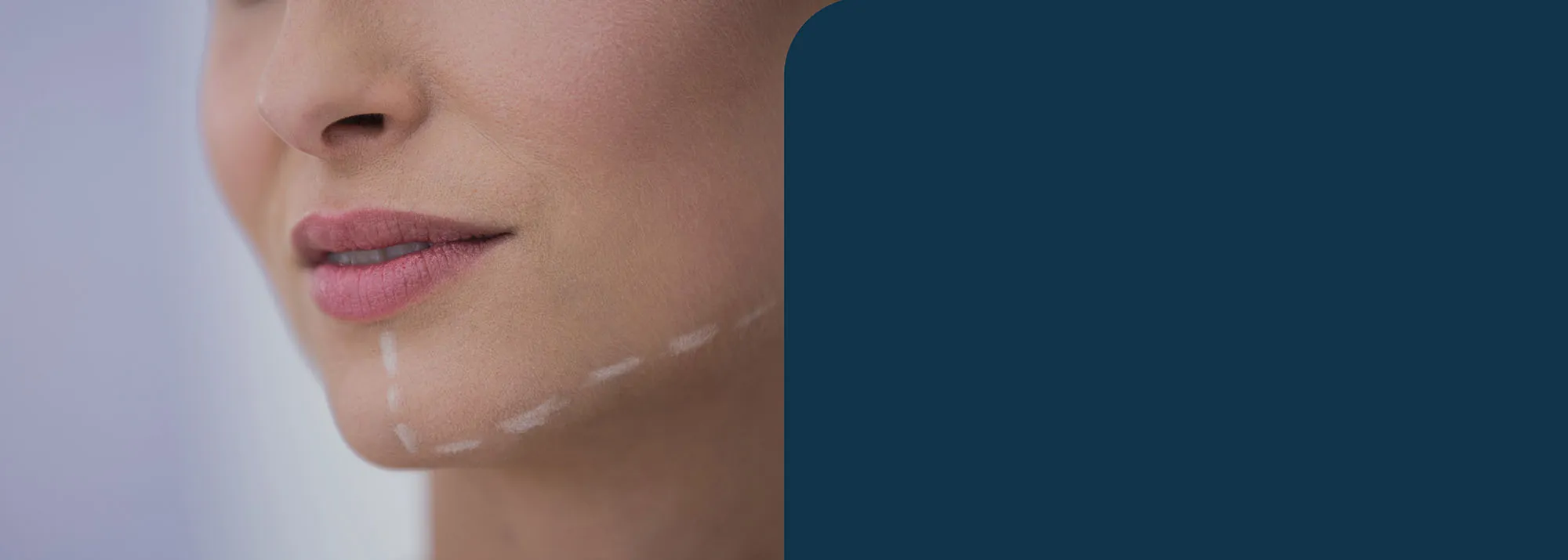 BAIRDMED services banners maxilla facial without