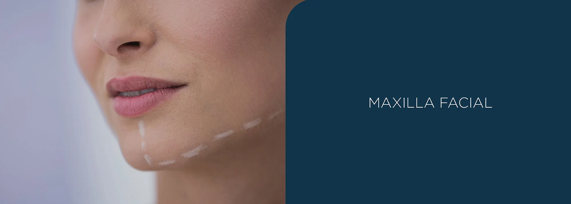 maxilla facial