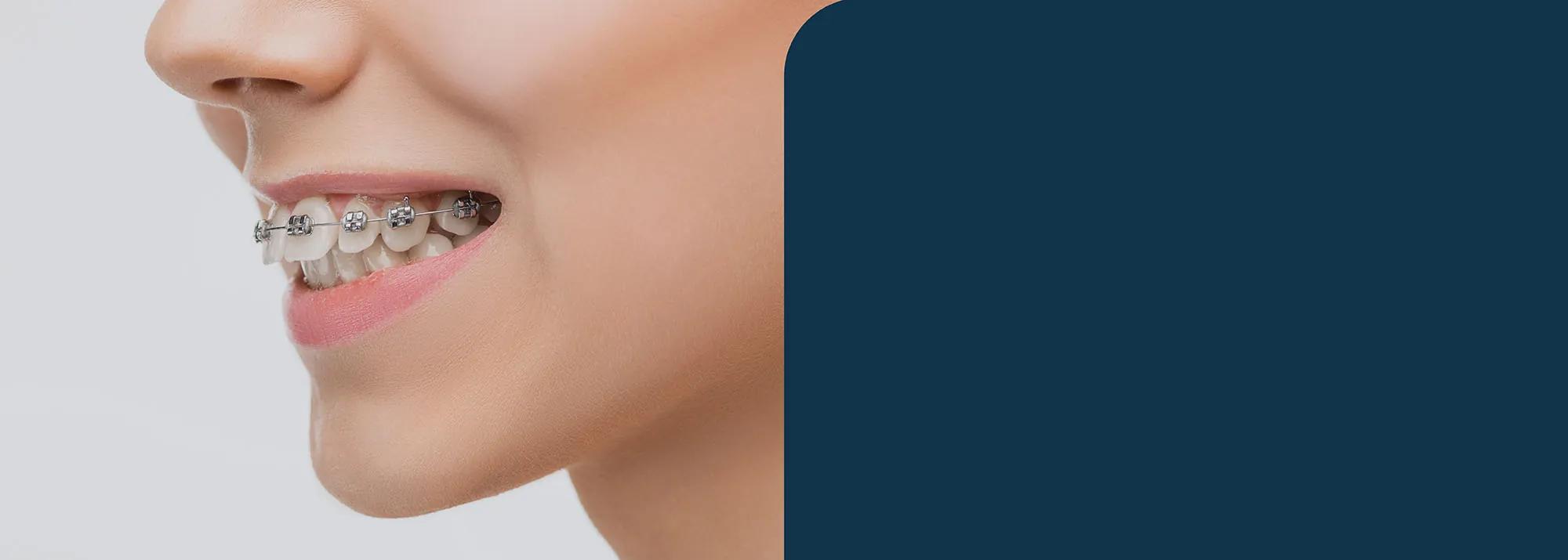 orthognathic surgery