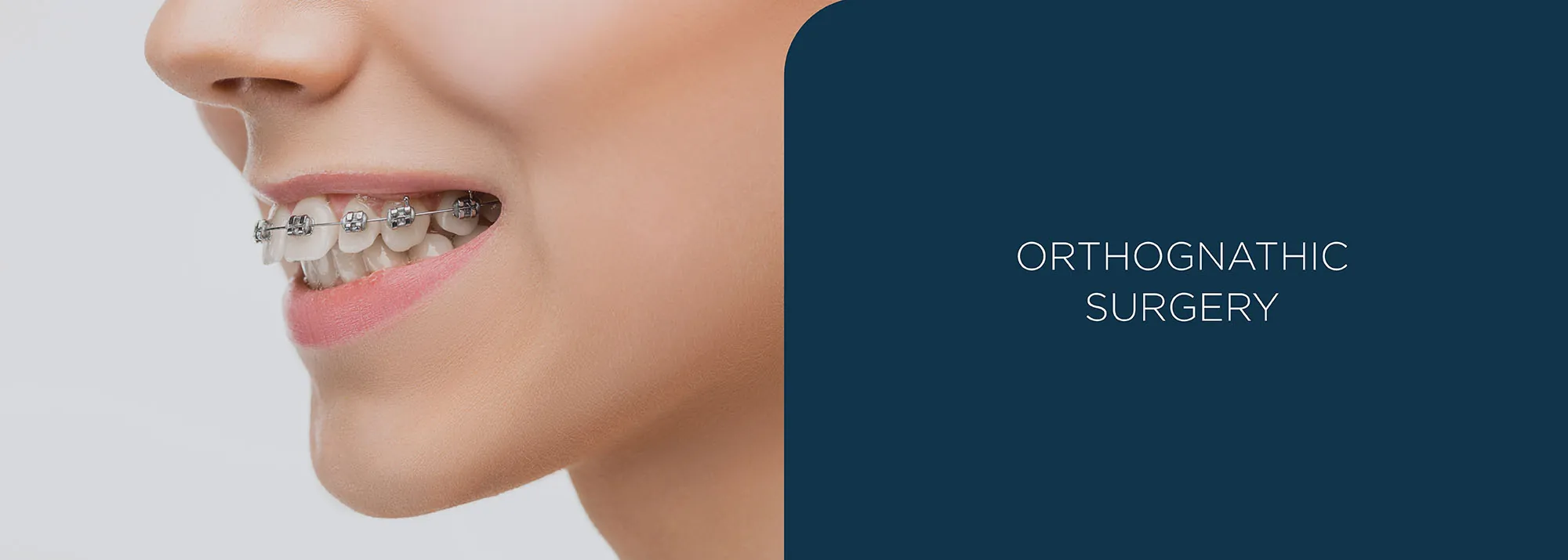 orthognathic surgery