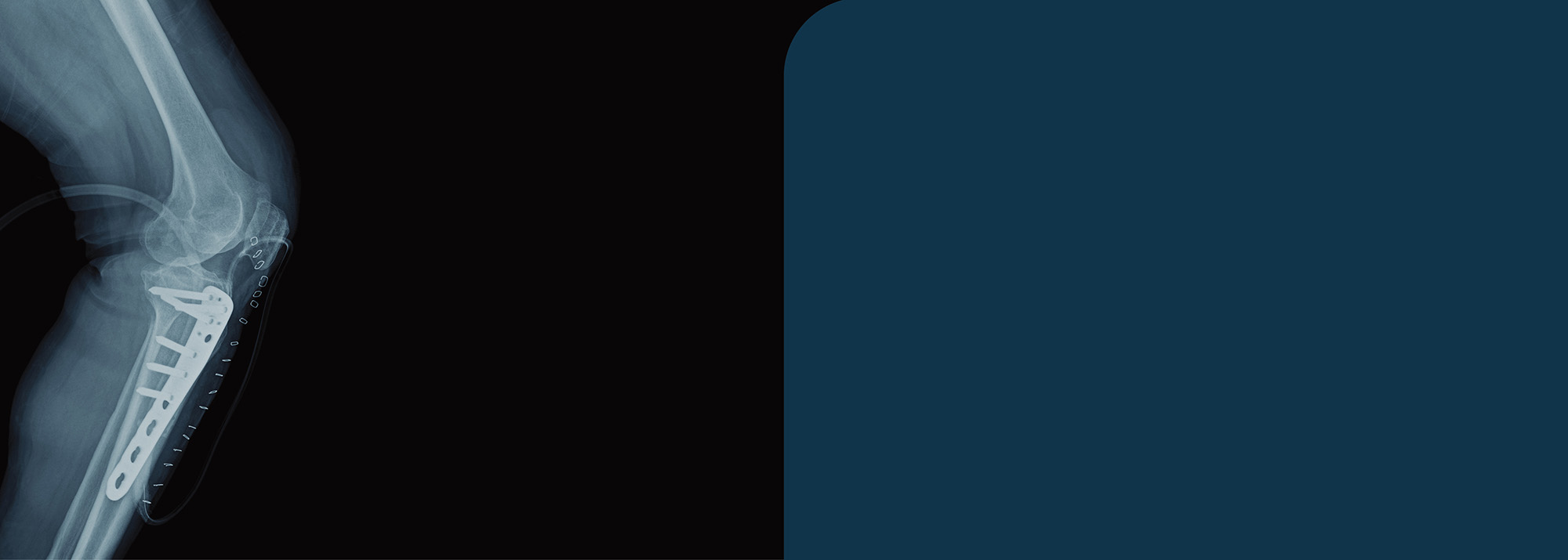 BAIRDMED trauma banner without